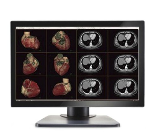 Double Black Imaging Image Systems Gemini 6MP Large Format Display